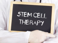 stem-cells-therapy