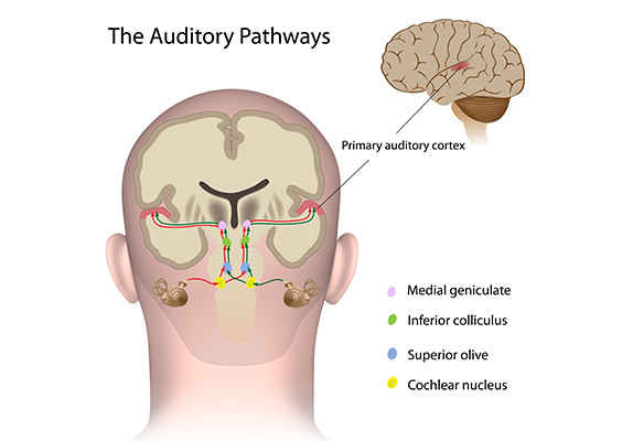 auditory-cortex