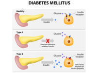 diabetes-mellitus