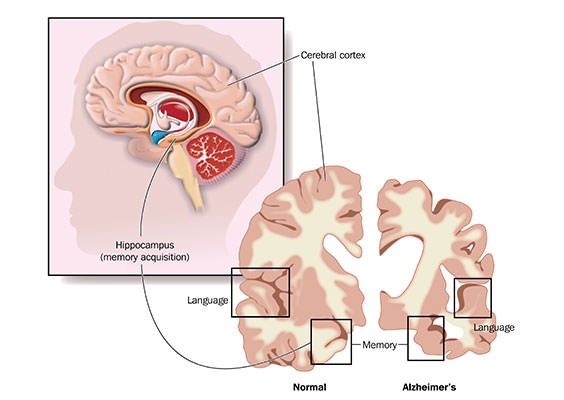 enhance-memory-brain-power