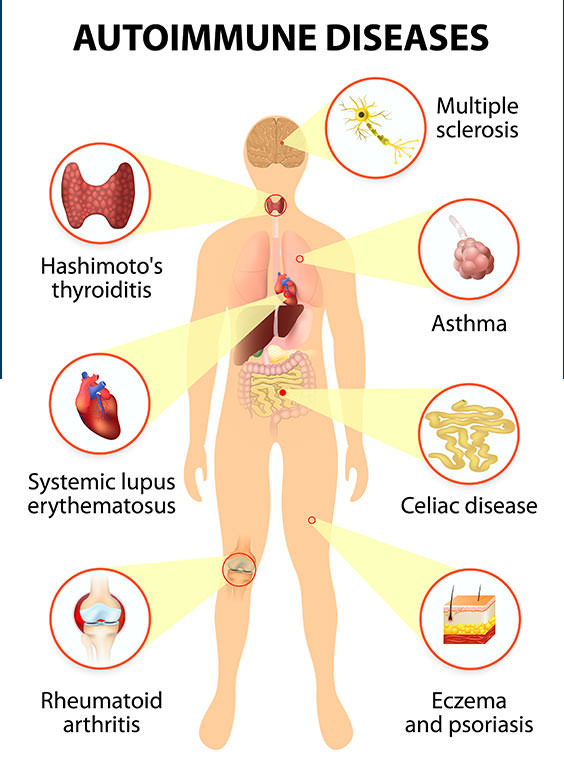 autoimmune-diseases