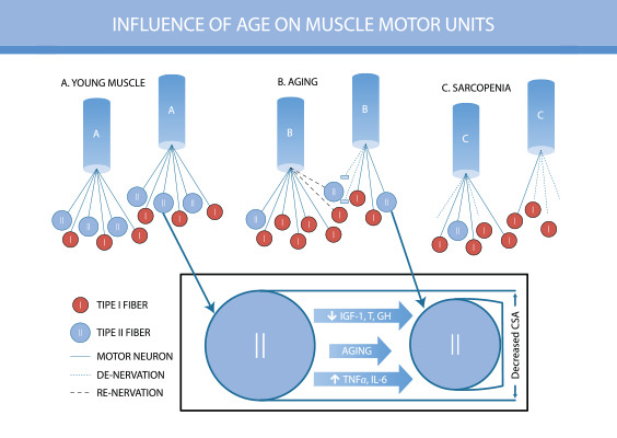 sarcopenia-age-muscle