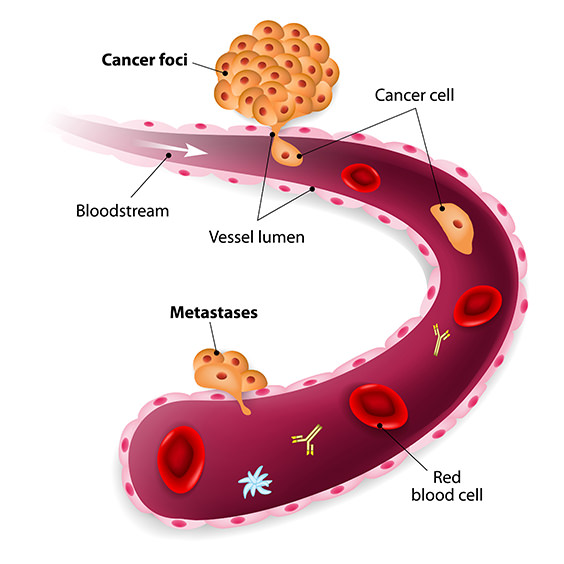 cancer-cells