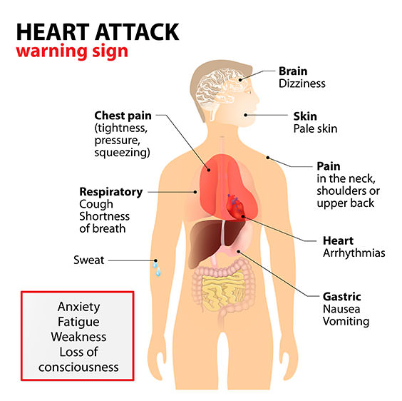 heart-attack-signs
