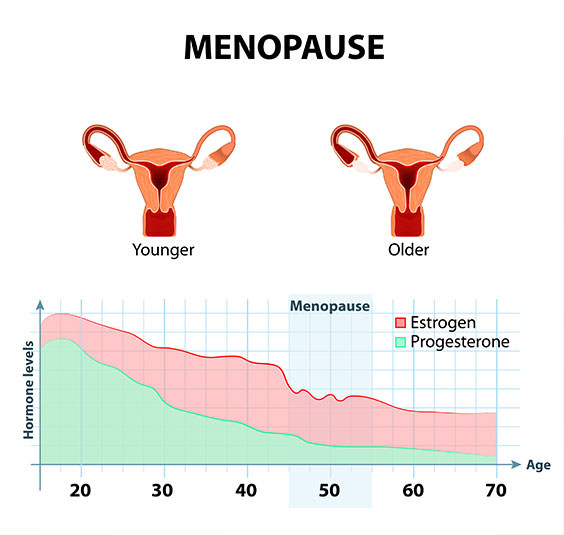 menopause